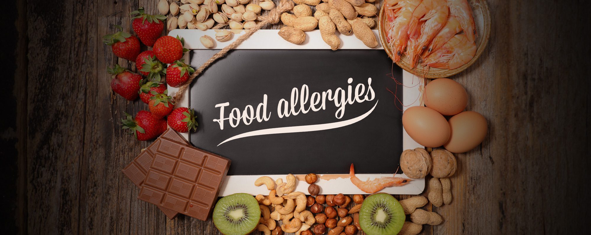 How to make your restaurant an allergy-friendly operation